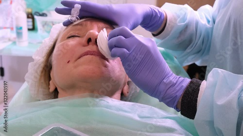 Middle aged woman 50 getting a lifting injection of an injection into the face by a doctor cosmetologist. Cosmetic procedure. close-up photo
