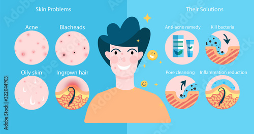 Young man bad skin problems ant treatment. Guy with pimples