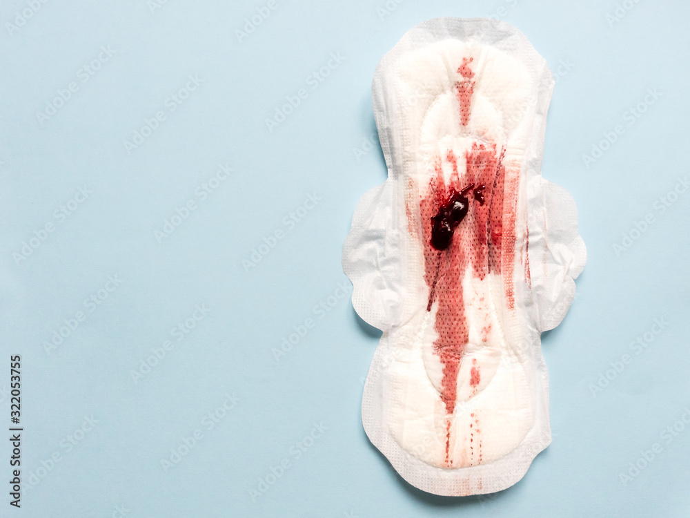 Symptom of endometriosis, menstrual blood with blood clots on a sanitary  pad. Stock Photo