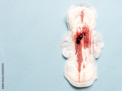 Symptom of endometriosis, menstrual blood with blood clots on a sanitary pad.