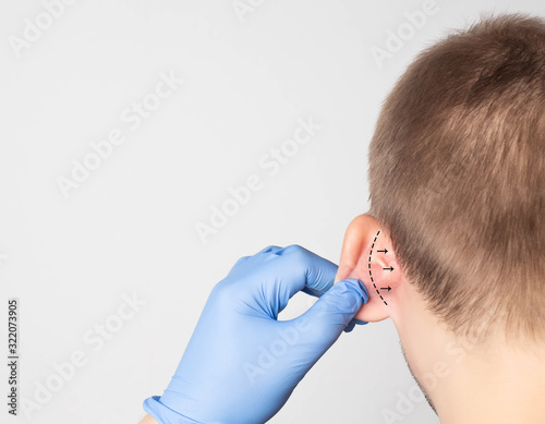 A plastic surgeon doctor examines a male patient s ear for an otoplasty operation. The concept of removing deafness, copy space photo