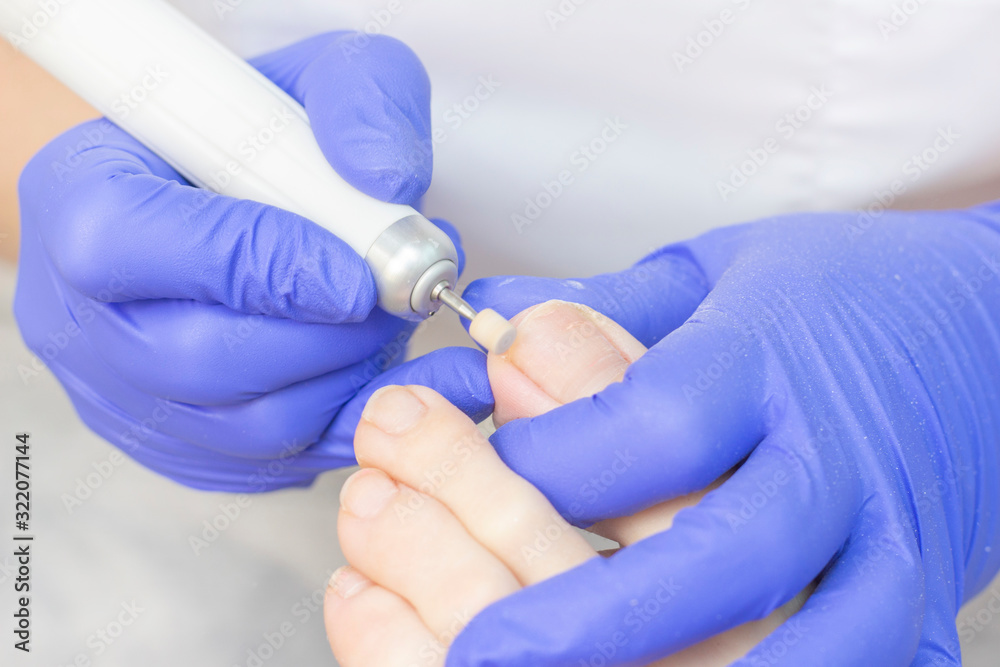 Therapeutic pedicure. Master podologist does hardware pedicure. visit to the podiatry. Foot treatment in the spa. Clinic of Podiatria. Therapeutic pedicure. Master podologist does hardware pedicure. visit to the podiatry. Foot treatment in the spa. Clinic of Podiatria.