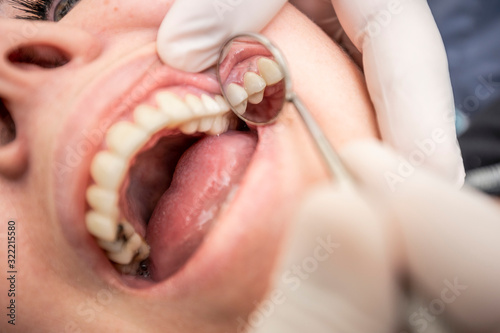 Dentista revisando dentadura de paciente