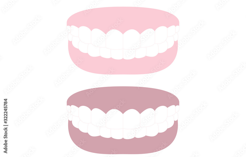 審美歯科 白い歯とピンクの歯茎 白い歯と黒ずんだ歯茎のイラスト Stock Vector Adobe Stock