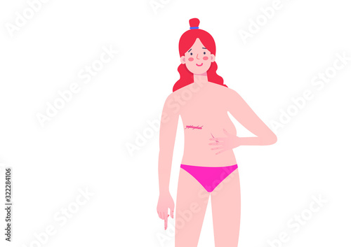 Naked ginger girl with a mastectomy in front of a jungle background, showing a body positive image and confidence as a cancer survivor. Strong woman with high self esteem 