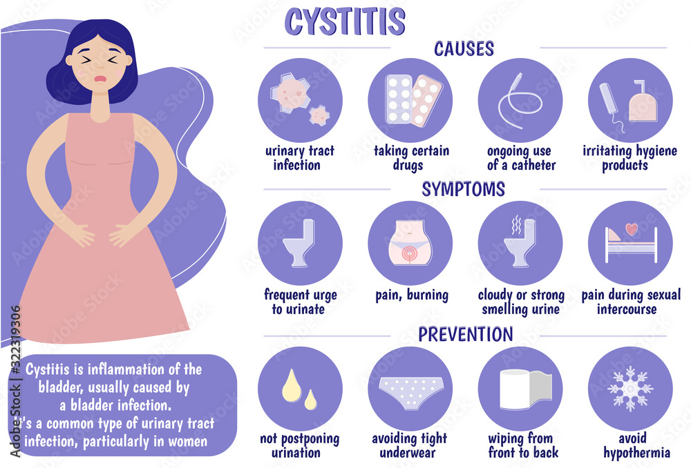 Cystitis. Medical infographics. Causes, symptoms, prevention of