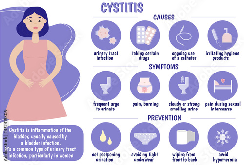 Cystitis. Medical infographics. Causes, symptoms, prevention of cystitis. Pain during urination, infection, catheter, tampons. Vector illustration.
