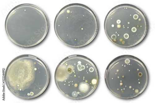 Vászonkép Bacteria on agar plate isolated from air