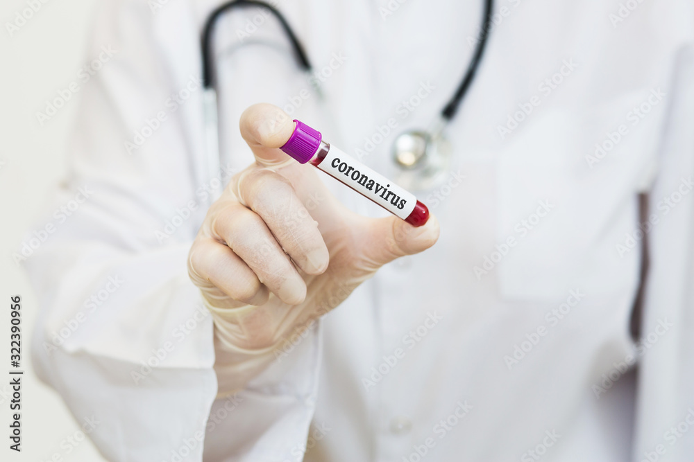 a doctor in a white coat, with a phonendoscope around her neck and gloves, holds a positive blood test for coronavirus COVID-2019. test tube with virus analysis