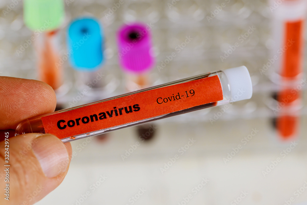 Obraz premium Coronavirus blood test Covid-19, 2019-nCoV,SARS-CoV, MERS-CoV blood test in Laboratory