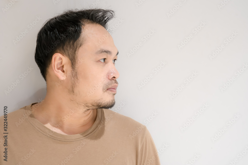 Naklejka premium Man is getting bald.Asian men with bald head problems