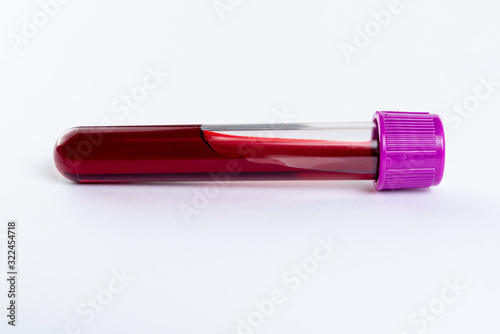 Tube with blood for blood test. White background.