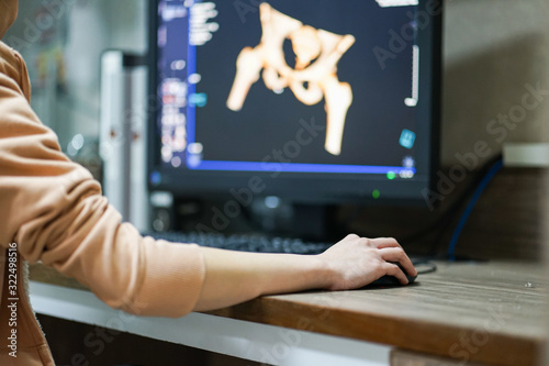 ็Hand holding mouse while working on CT scan workstaion with blur 3D VRT hip bone reconstruction background