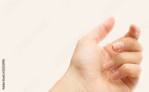 Quadro su tela Close up woman nails after bad manicure on light background