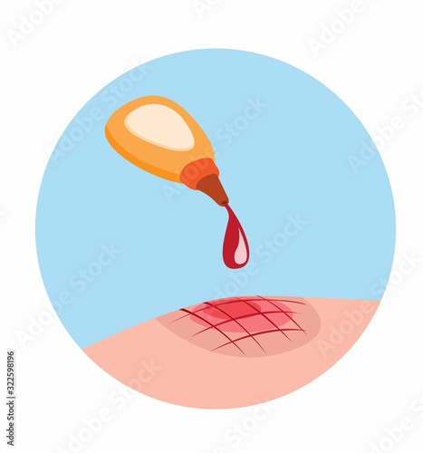 betadine on scar, iodin povidon liquid to anti septic from scratch skin symbol cartoon flat illustration vector eps 10