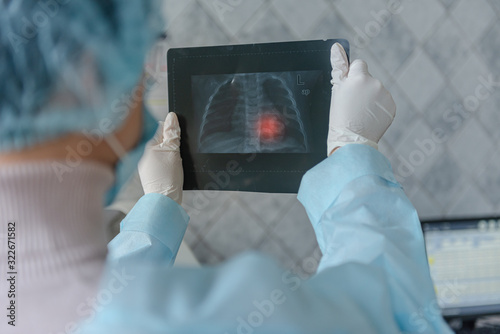 A doctor is looking at a fluorography scan of a patient with coronavirus disease. photo