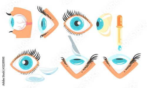 Ophthalmologist Diagnostic and Correction of Vision Collection, Human Eye Treatment Vector Illustration