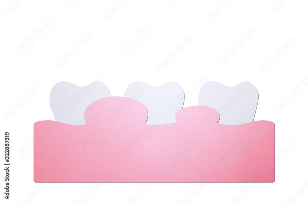 periodontitis or gum disease with swell ( swollen on gum and tooth because inflammation ), dental problem - teeth cartoon paper cut style
