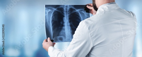 Doctor in a white coat holding an x-ray radiogram