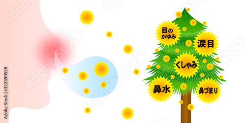 花粉　杉　アレルギー　背景
