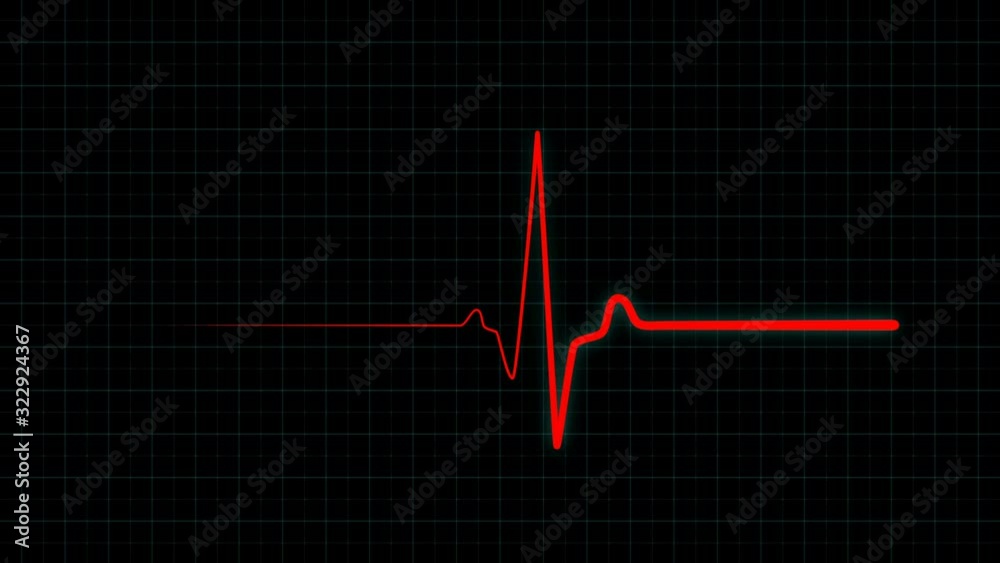 Red flatline medical EKG screen, heart failure and patient's death on ECG monitor. Resuscitation of a patient with a heart attack on ECG monitor. Seamlessly looping animation in 4K