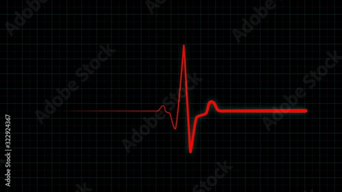 Red flatline medical EKG screen, heart failure and patient's death on ECG monitor. Resuscitation of a patient with a heart attack on ECG monitor. Seamlessly looping animation in 4K