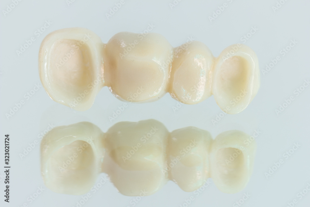 4 units zirconia bridge with all porcelain with a reflection on the glass. 4 units zirconia bridge with all porcelain with a reflection on the glass.