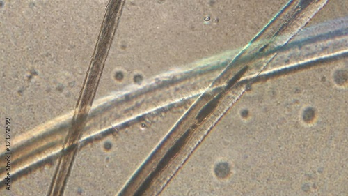 Wallpaper Mural Microscopy of human hair (eyelash and eyebrow). Magnification 150x  root and hair stalk  in detail under microscope. Torontodigital.ca