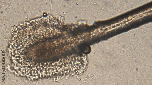 Microscopy of human hair (eyelash and eyebrow). Magnification 150x  root and hair stalk  in detail under microscope.