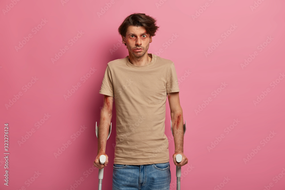 People, health care and accident concept. Handicapped traumatized man