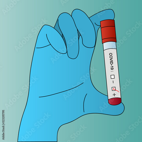 Diagnostics passed. The blood sample is positive. Coronavirus infection detected. Vector illustration. Isolated background. Test tube with patient analysis in the hands of a laboratory assistant.