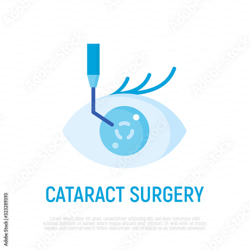 Cataract surgery flat icon. Ophthalmology. Lasik vision correction. Modern vector illustration.