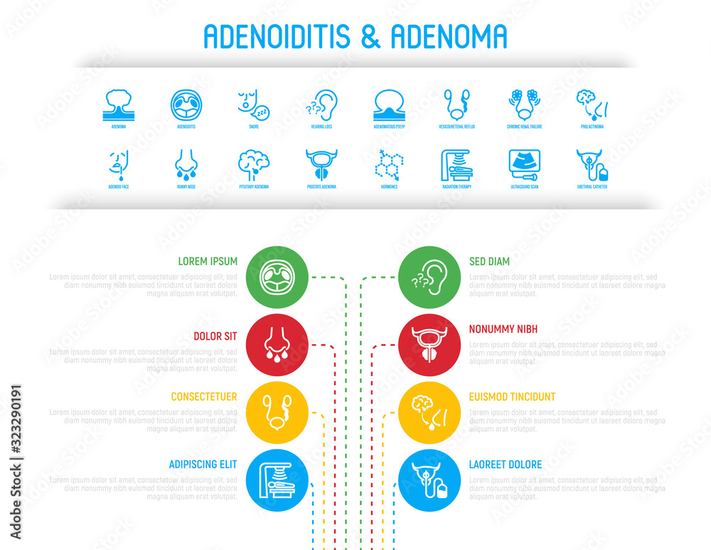 Adenoiditis and adenoma infographics with thin line icons. Benign tumor, hearing loss, adenoid face, adenomatous polyp, prolactinoma, hormones, radiation therapy, ultrasound scan. Vector illustration.