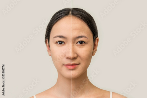 the female face of an Asian woman, the concept of beauty before and after contrast, the power of retouching. skin care, prolongation of youth. women's cosmetology 
