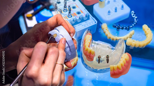Dentist at work. Working wi...