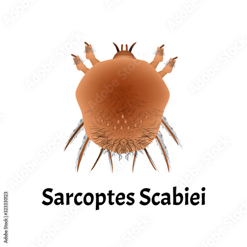 Sarcoptes scabiei. scabies. Sexually transmitted disease. Infographics. Vector illustration on isolated background.
