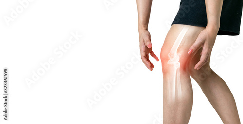 Fotografia Human leg Osteoarthritis inflammation of bone joints on white background