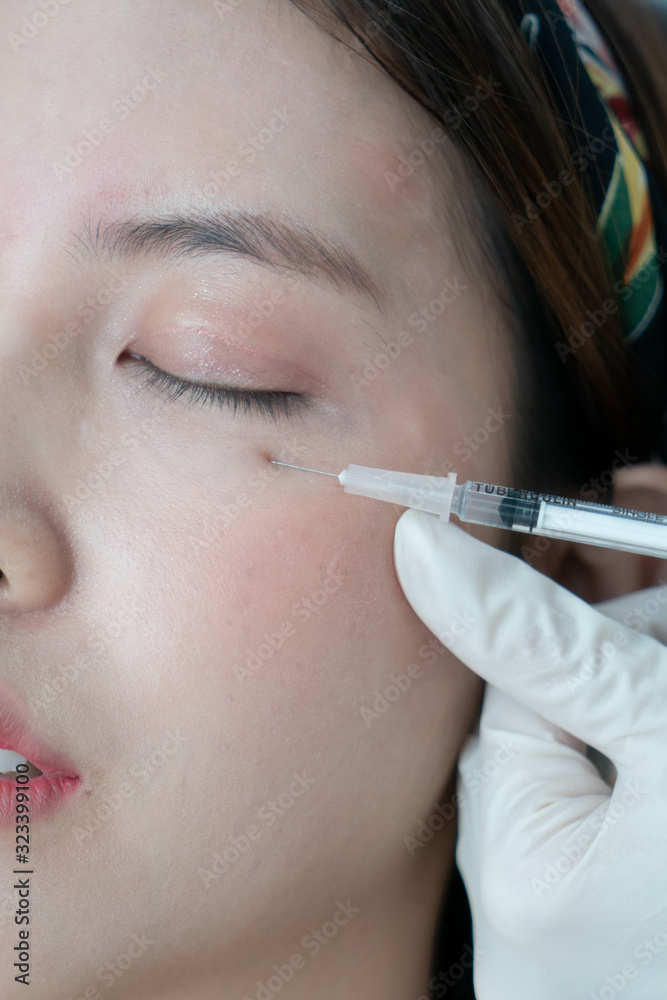 Botox, Filler injection for Asian female face. Plastic aesthetic facial surgery in beauty clinic. Botox, Filler injection for Asian female face. Plastic aesthetic facial surgery in beauty clinic.