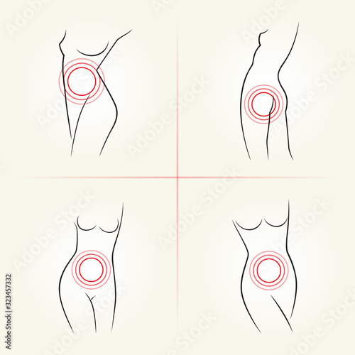 Woman body correction with the help of plastic surgery concept. Weight loss. Vector illustration