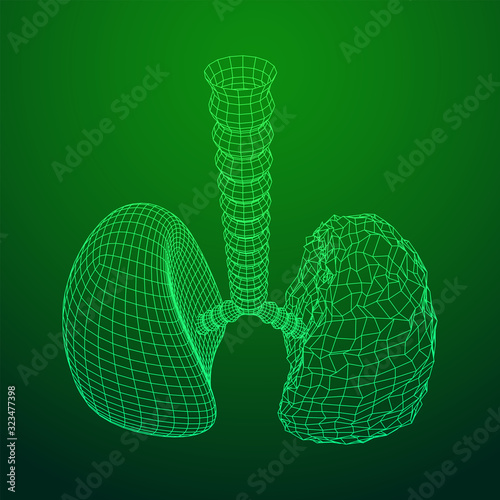Healthy and sick lung with trachea bronchi internal organ human. Pulmonology medicine science technology concept. Wireframe low poly mesh vector illustration