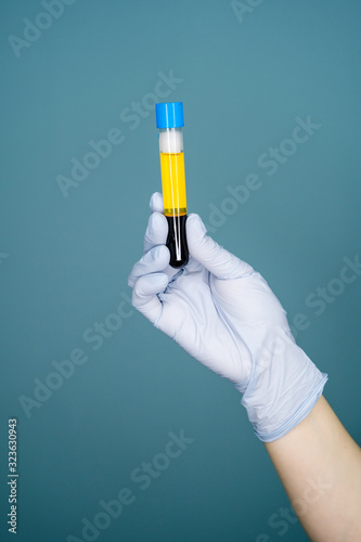 Blood plasma in vitro gloved hand holding