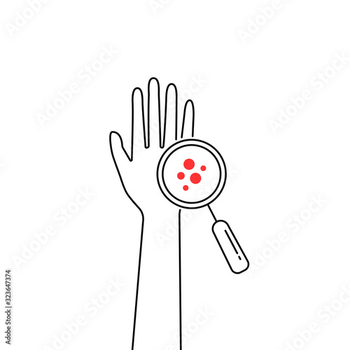 linear scheme eczema on human hand