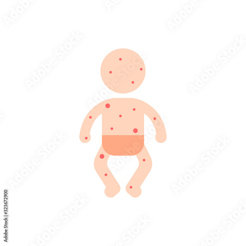 baby with red spots all over body
