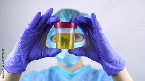Female doctor shows urine test closeup. 4k photo