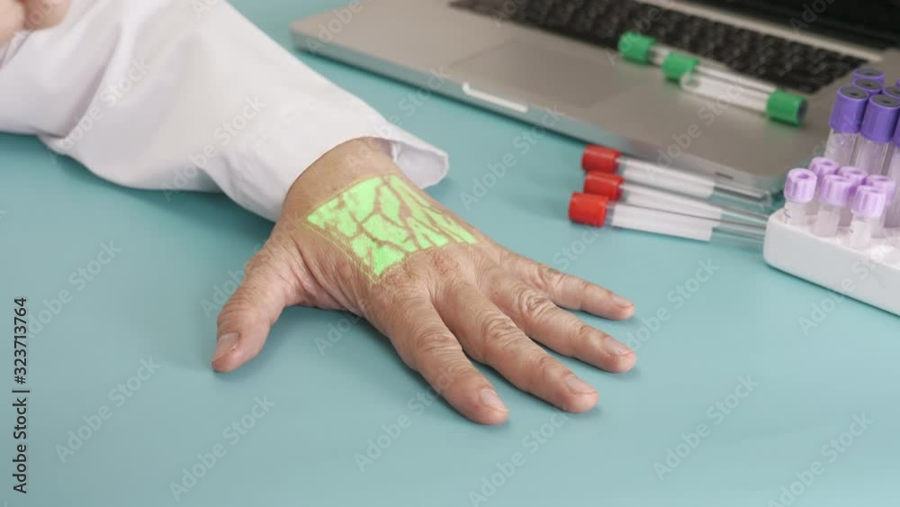 A laboratory technician utilizing a vein scanner apparatus to visualize and identify veins on the dorsum of a hand for blood drawing. A laboratory technician utilizing a vein scanner apparatus to visualize and identify veins on the dorsum of a hand for blood drawing.