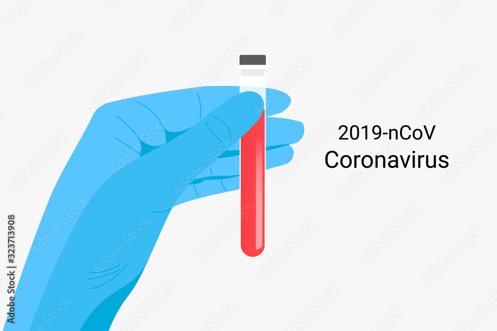 Wuhan coronavirus 2019-nCoV concept. Wuhan coronavirus 2019-nCoV concept.