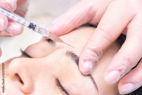Close-up of a beautician injecting Botox into forehead wrinkles. She holds a syringe. Botox injection. Cosmetics injected womans face