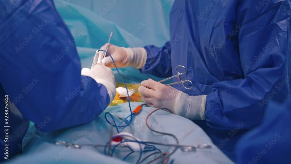 Close up of surgery process. Medical team of surgeons in hospital doing minimal invasive surgical interventions