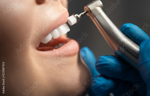 process of using dental brush as a stage of professional dental cleaning procedure in clinic close up   Beautiful Woman Healthy Smile close up  healthcare concept