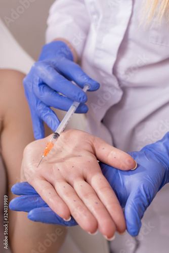 Close-up Of Beautician s Hand. A doctor performing injections in the palm of the hand. Cosmetology procedures for diseases and premature aging and wrinkles of the skin.